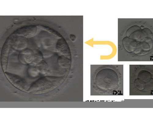 国内私立供卵医院排名最新,雅士利能慧奶粉市场价格 雅士利能慧奶粉为什么便宜