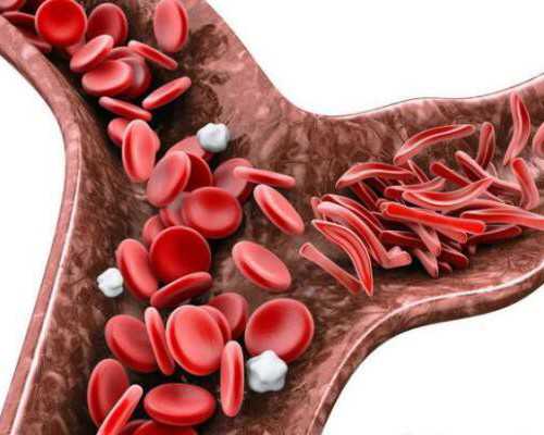 国内代生的收费,尿蛋白高最怕三种水果？尿蛋白高饮食禁忌有哪些！