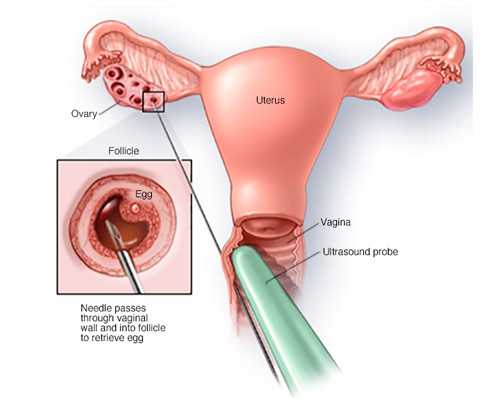 国内供卵做试管怎么样,试管婴儿促排卵12个可以配几个胚胎[试管婴儿胚胎]